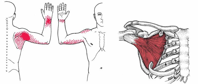 Subscapularis - Afbeelding 2