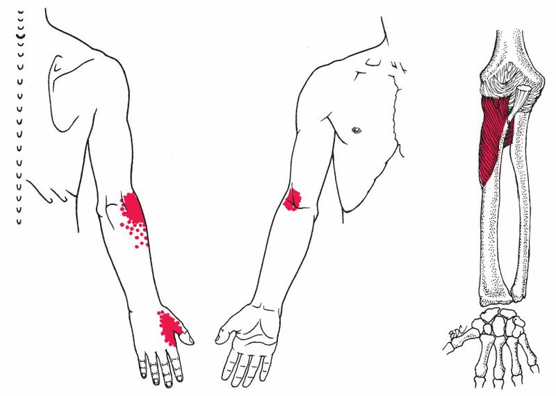 Supinator - Afbeelding 3