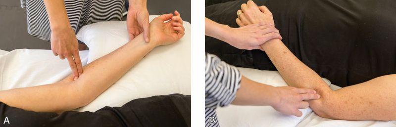 Supinator - Afbeelding 4