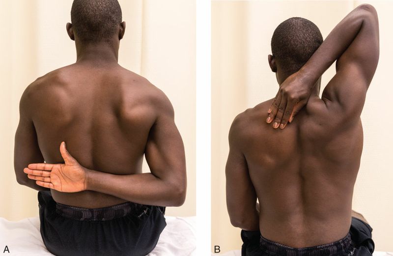 Supraspinatus - Afbeelding 3