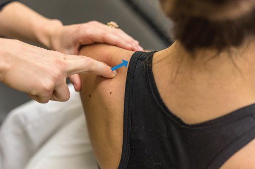 Supraspinatus - Afbeelding 4