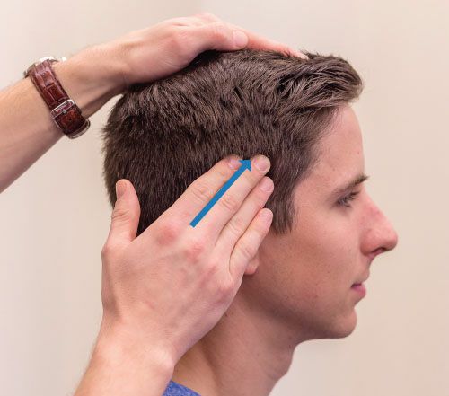 Temporalis - Afbeelding 3