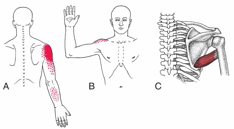 Teres Major - Afbeelding 2