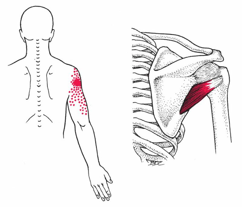 Teres Minor - Afbeelding 2