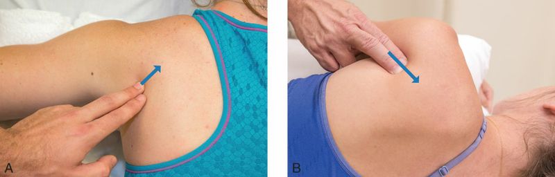 Teres Minor - Afbeelding 3