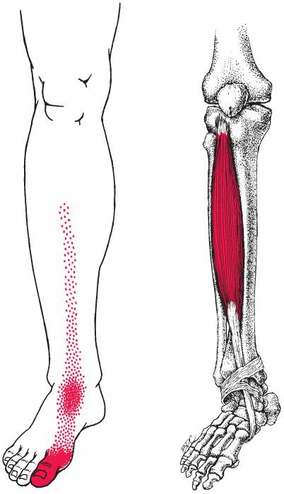 Tibialis Anterior - Afbeelding 3