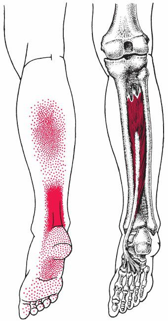 Tibialis Posterior - Afbeelding 3