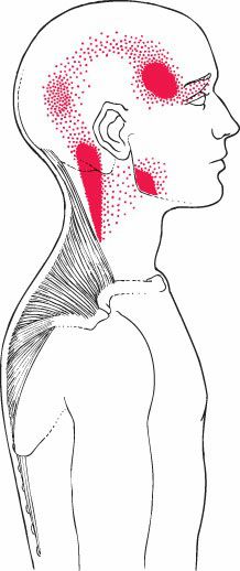 Trapezius - Afbeelding 4