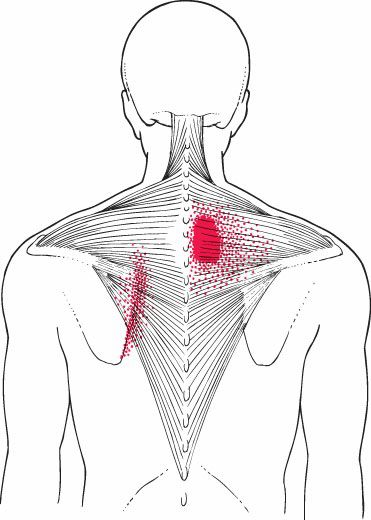 Trapezius - Afbeelding 6