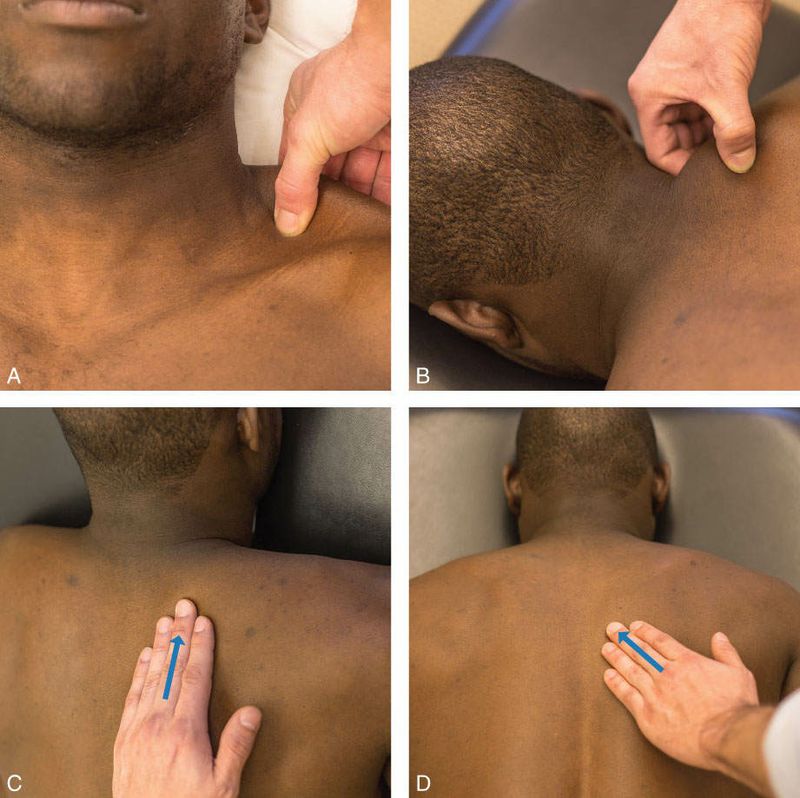 Trapezius - Afbeelding 8