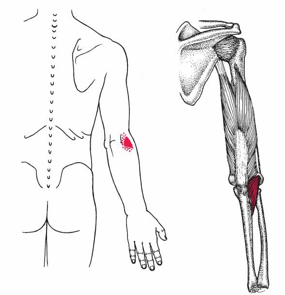 Triceps Brachii - Afbeelding 5